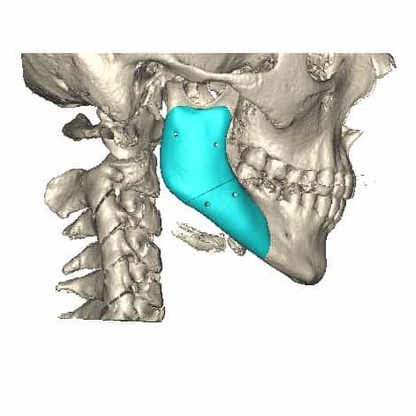 Jaw 3D Scan Attenborough Medical